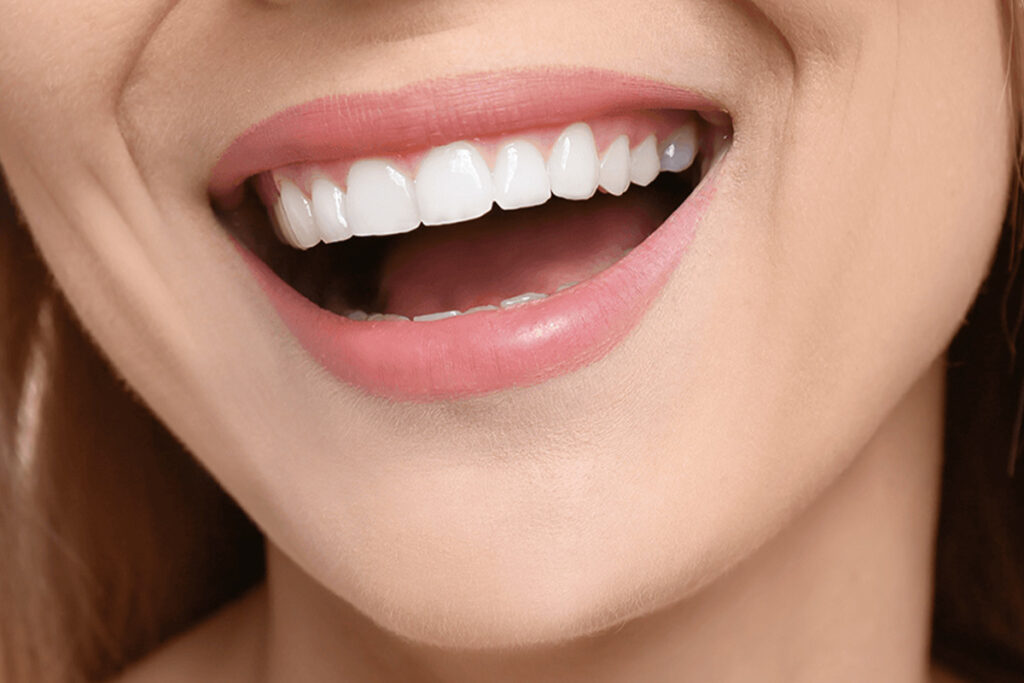 Hollywood Smile in der Türkei